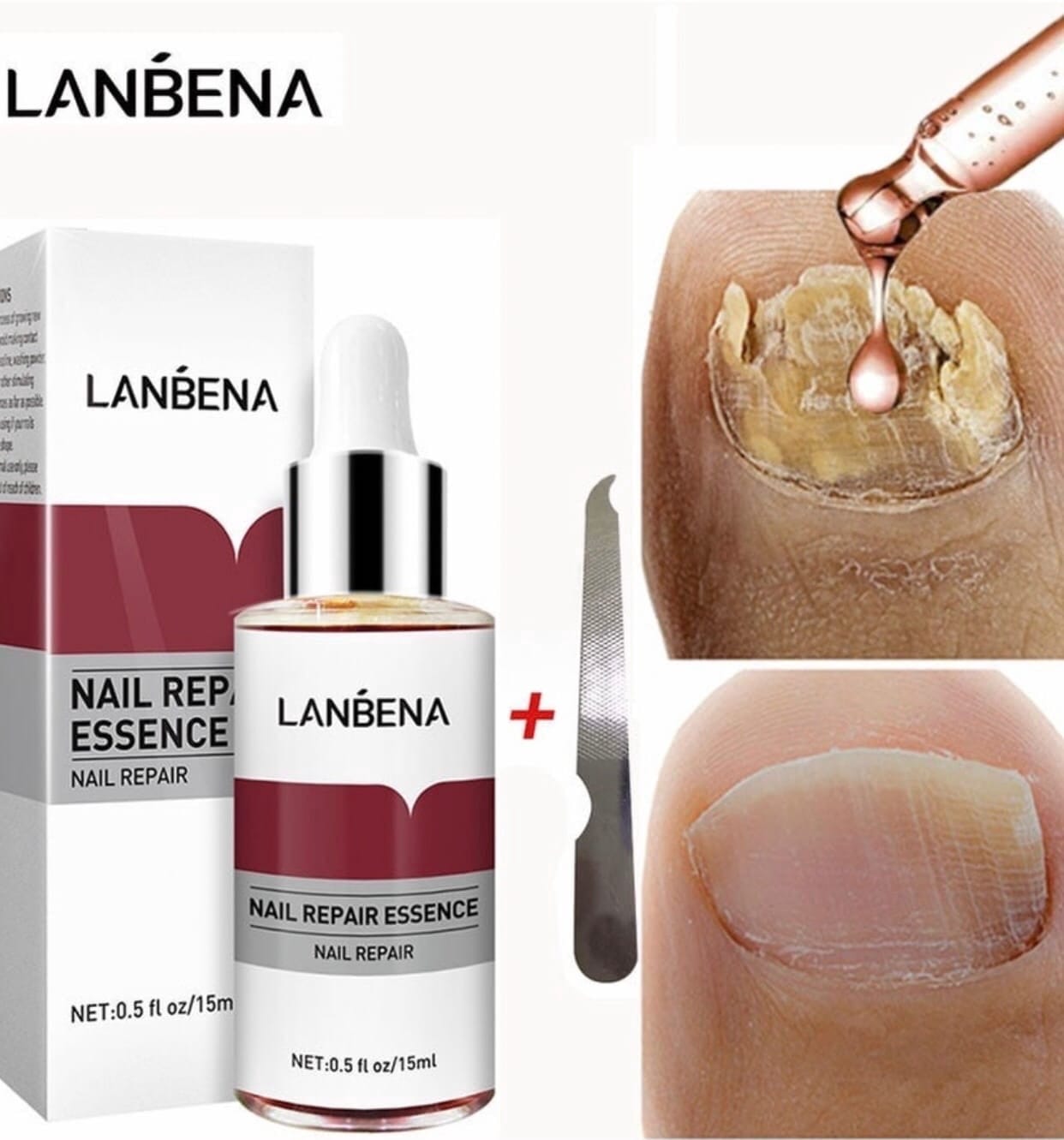 фото Противогрибковое средство для ногтей Lanbena Nail Repair Essence 861728 интернет магазин Stok-m.ru